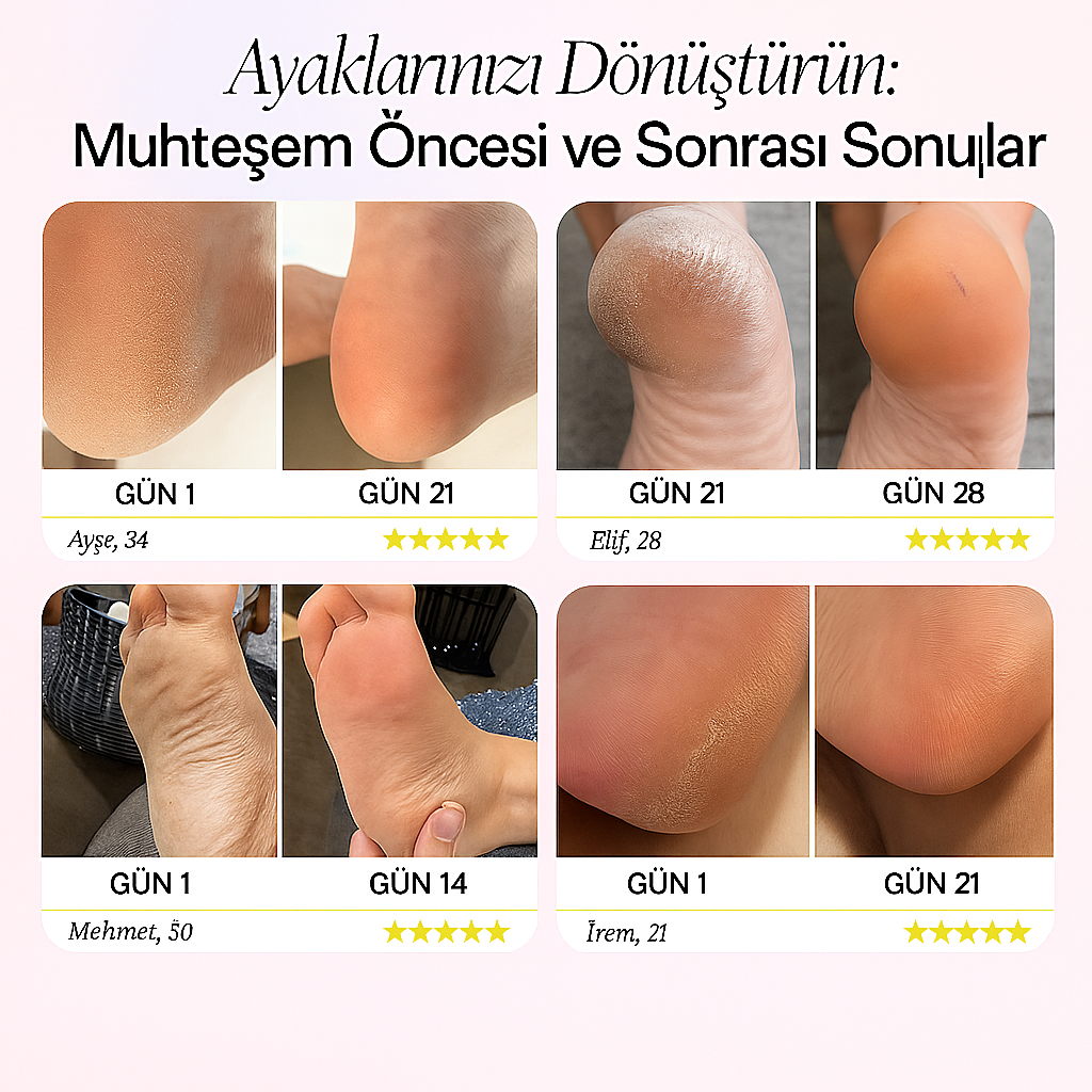 Pedisera Ayak Törpüsü